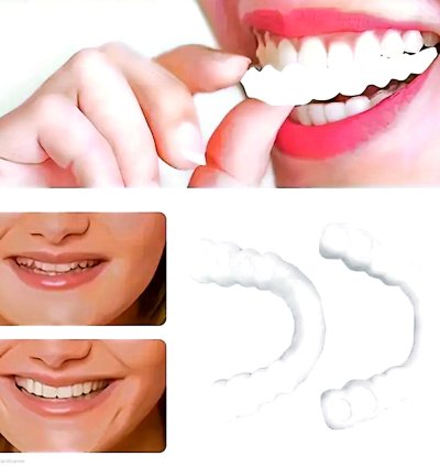 White Denture Porcelain Teeth Cover - Upper and Lower